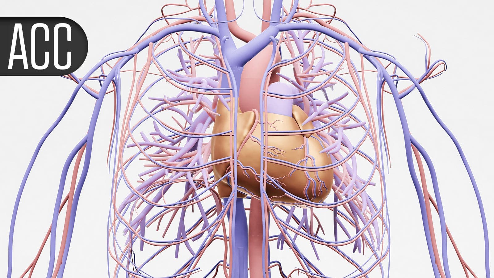 Angiography-Based FFR Matches Wire-Guided Outcomes At One-Year