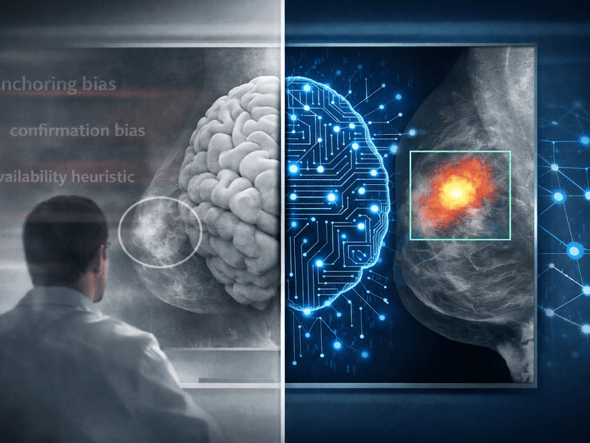 AI Reveals Diagnostic Biases In Breast Imaging
