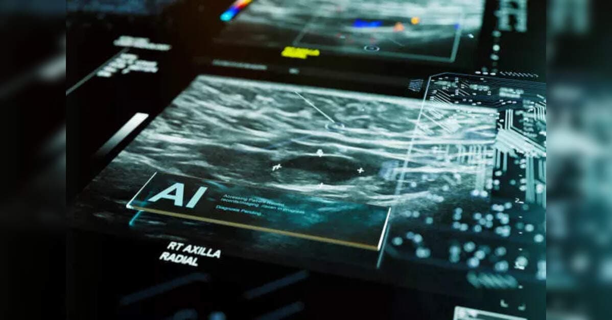 AI Enhances National Breast Cancer Screening Outcomes